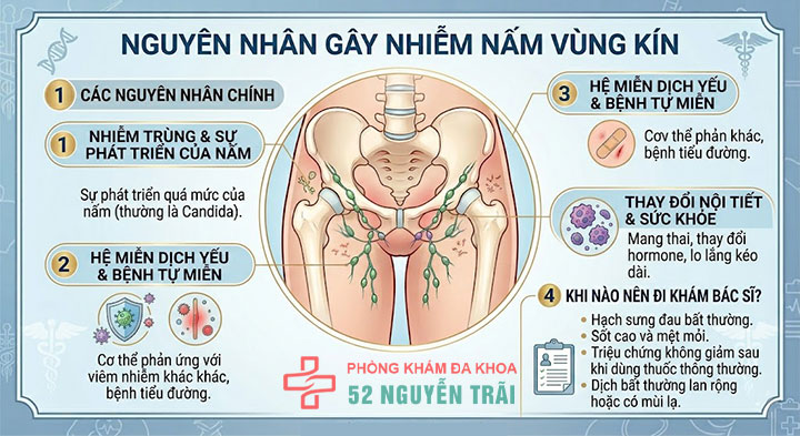 Nấm vùng kín: Triệu chứng, nguyên nhân và cách xử lý 5 Nguyên nhân gây nhiễm nấm vùng kín