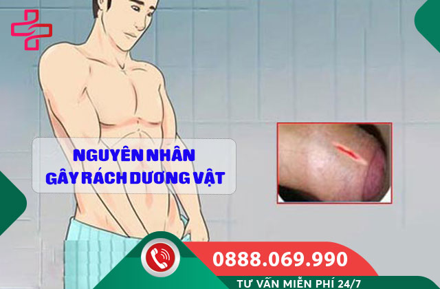 Nguyên nhân gây rách dương vật