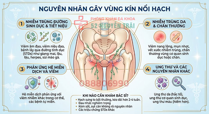 Vùng kín nổi hạch do đâu? Cách điều trị an toàn, hiệu quả 2 Nguyên nhân gây vùng kín nổi hạch