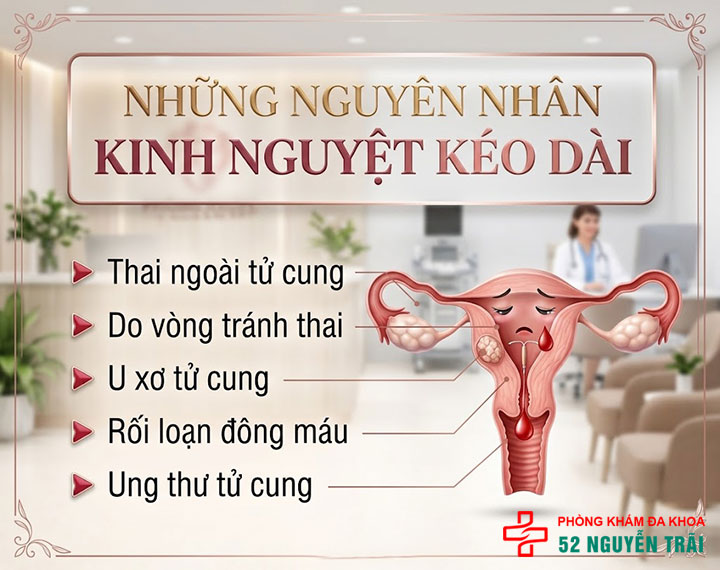 Kinh nguyệt kéo dài, Nguyên nhân, Cách chữa 1 nguyên nhân kinh nguyệt kéo dài
