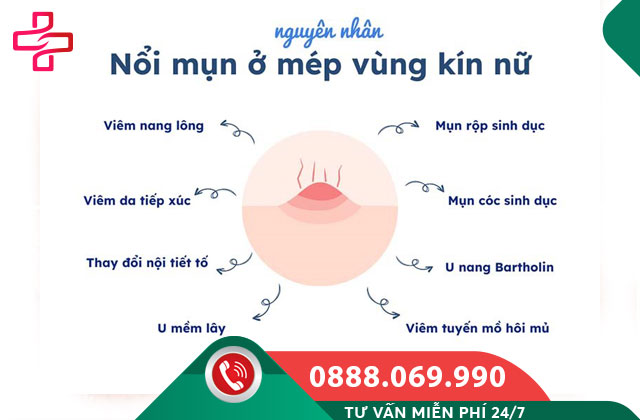 Các nguyên nhân phổ biến gây nổi mụn ở cô bé