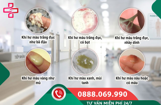 Nhận Biết Khí Hư Bất Thường Theo Màu Sắc