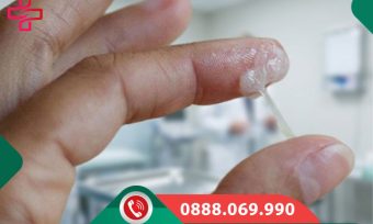 Nhận Biết Khí Hư Sinh Lý Bình Thường