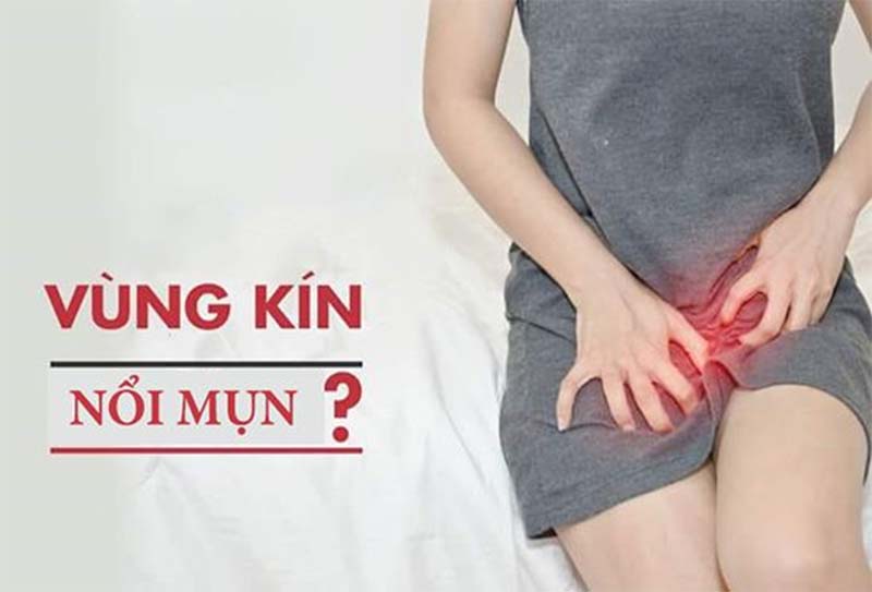 Nổi mụn ở cô bé
