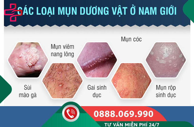 Nổi Mụn Ở Dương Vật