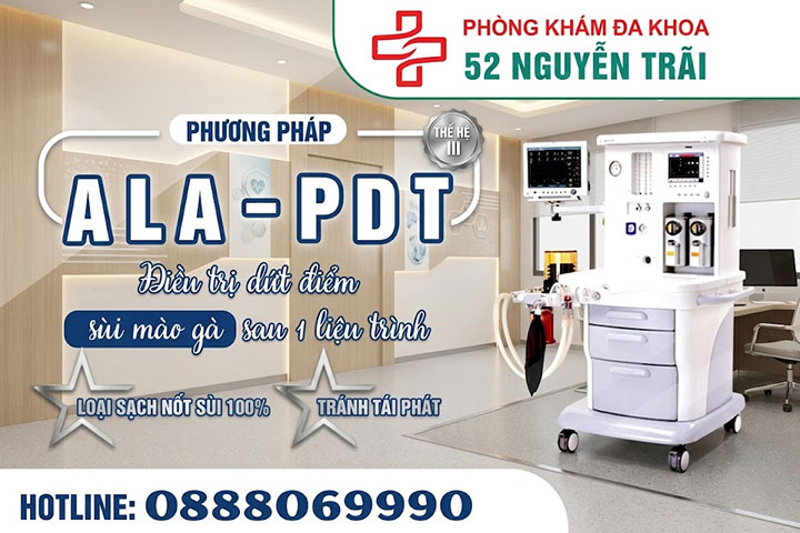 phương pháp ala pdt