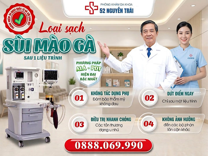 Phương pháp chữa sùi mào gà