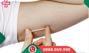 Que tránh thai là gì?