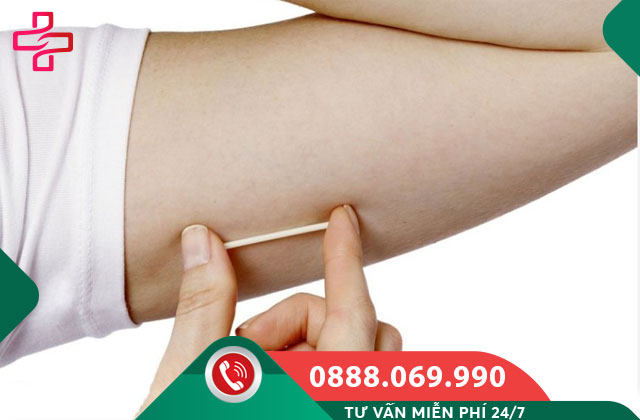 Que tránh thai là gì?