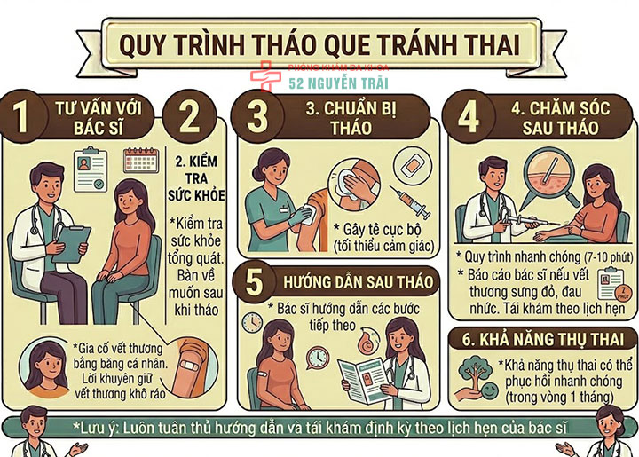 Cấy que tránh thai: Giải pháp ngừa thai hiện đại, an toàn 11 Quy trình tháo que tránh thai