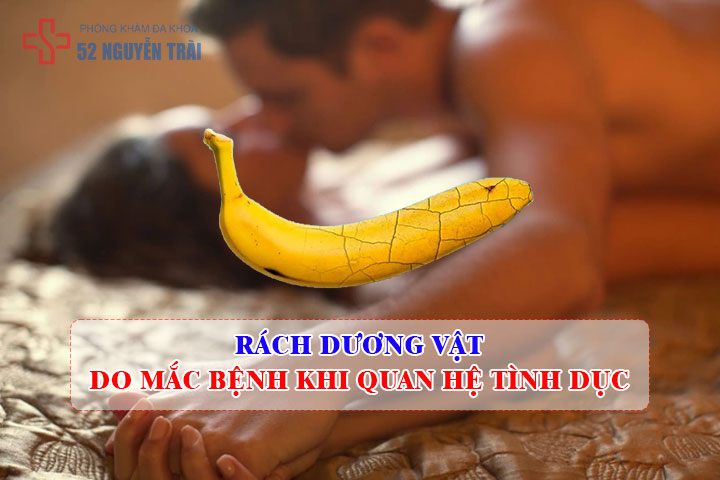 Rách dương vật Do mắc bệnh khi quan hệ tình dục