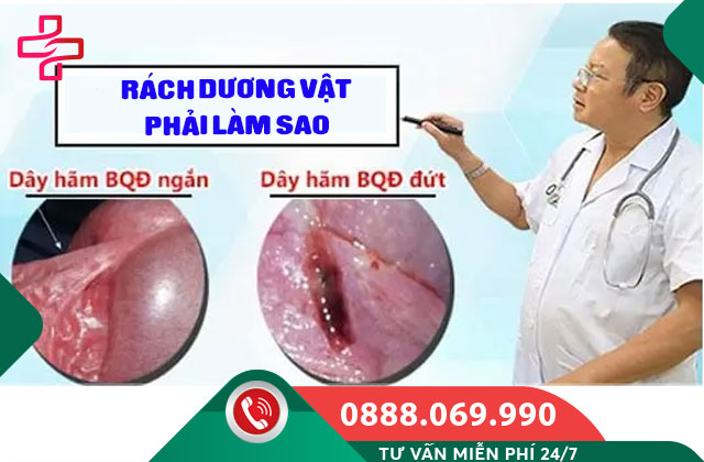 RÁCH DƯƠNG VẬT PHẢI LÀM SAO