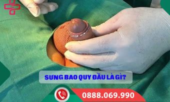 Sưng bao quy đầu do đâu? Nguyên nhân và cách xử lý an toàn