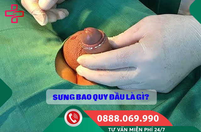 Sưng bao quy đầu là gì?
