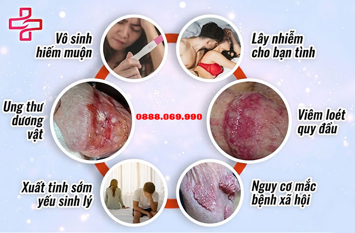 Tác hại của loét bao quy đầu