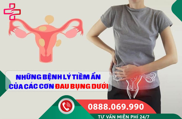Những bệnh lý tiềm ẩn của các cơn đau bụng dưới