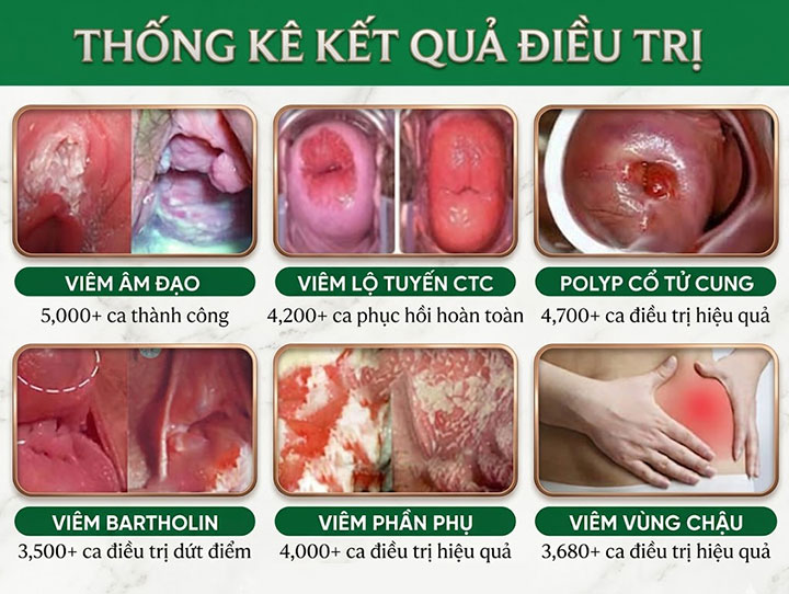 thống kê kết quả điều trị