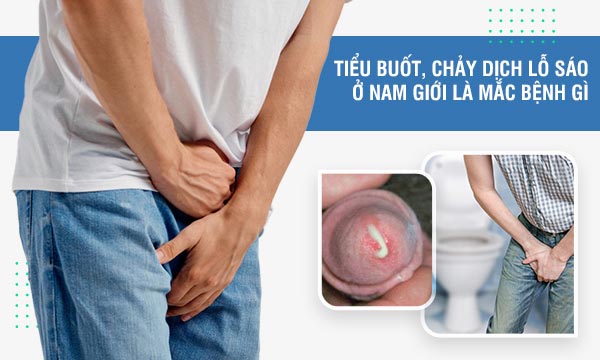 Tiểu buốt, tiểu đau rát, tiểu ra máu là bệnh gì?