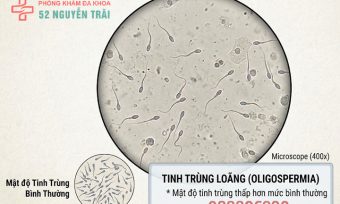 Xét nghiệm tinh trùng loãng – kiểm tra chức năng sinh sản bảo mật tại hà nội