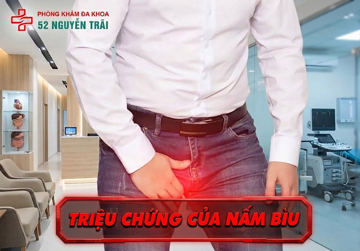 Triệu chứng của nấm bìu