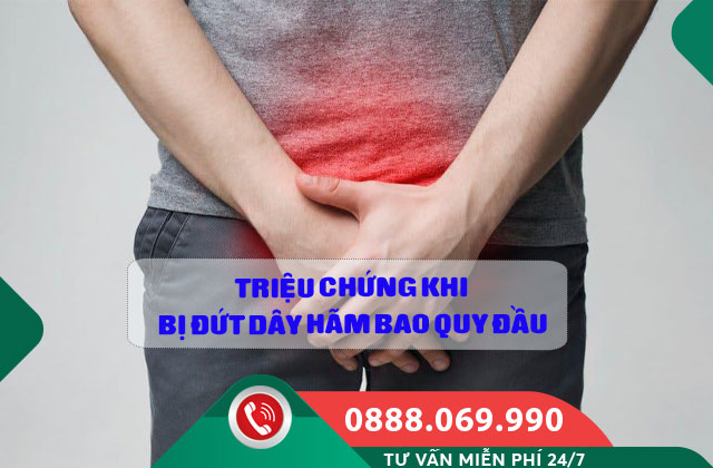 Triệu Chứng Khi Bị Đứt Dây Hãm Bao Quy Đầu
