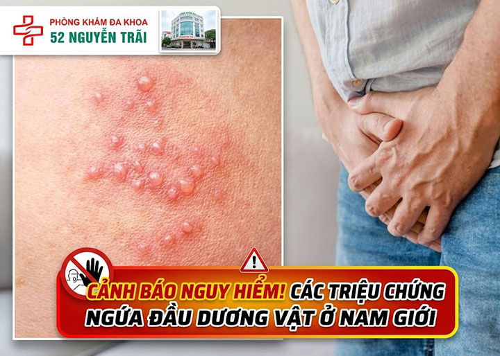 triệu chứng ngứa dầu dương vật