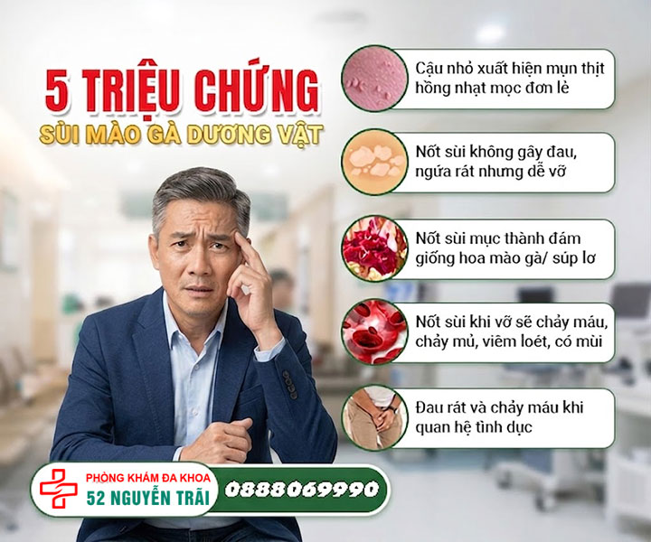 triệu chứng sùi mào gà dương vật