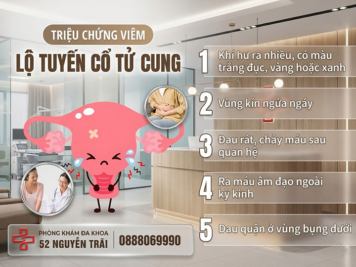 triệu chứng viêm lộ tuyến cổ tử cung