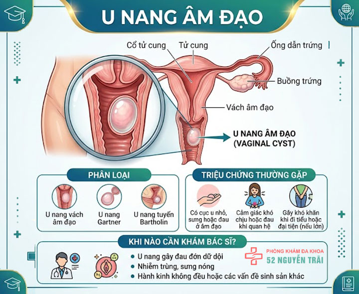 Vùng kín nổi hạch do đâu? Cách điều trị an toàn, hiệu quả 5 U nang âm đạo