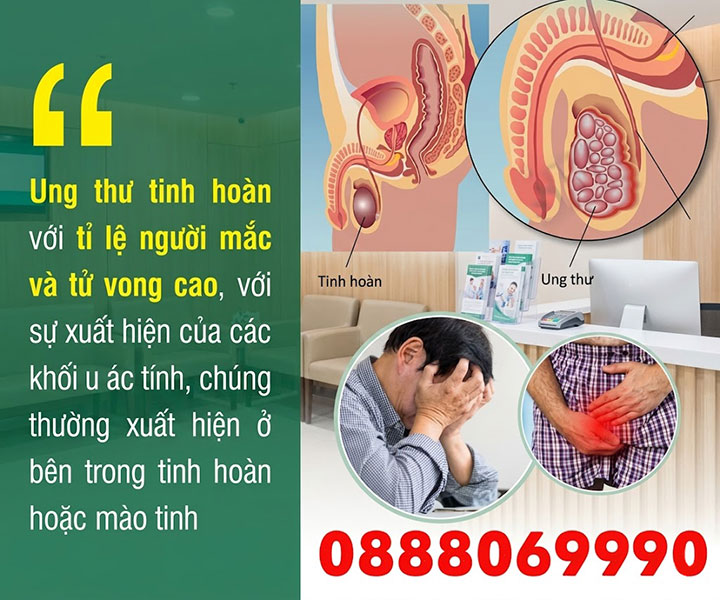 Đau nhức tinh hoàn tại sao? Dấu hiệu của của bệnh gì? 5 Ung thư tinh hoàn