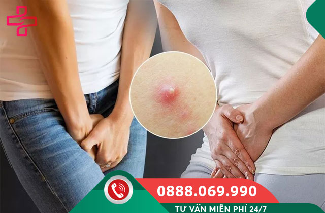 vệ sinh không đúng cách gây nổi mụn ở cô bé