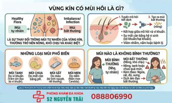 Vùng kín có mùi do đâu? Cách điều trị an toàn, hiệu quả