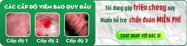 live chat viêm bao quy đầu