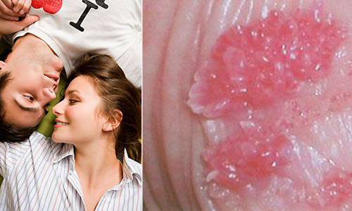 Xét nghiệm các bệnh lây qua đường sinh dục