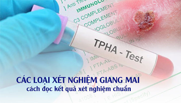 Xét nghiệm giang mai