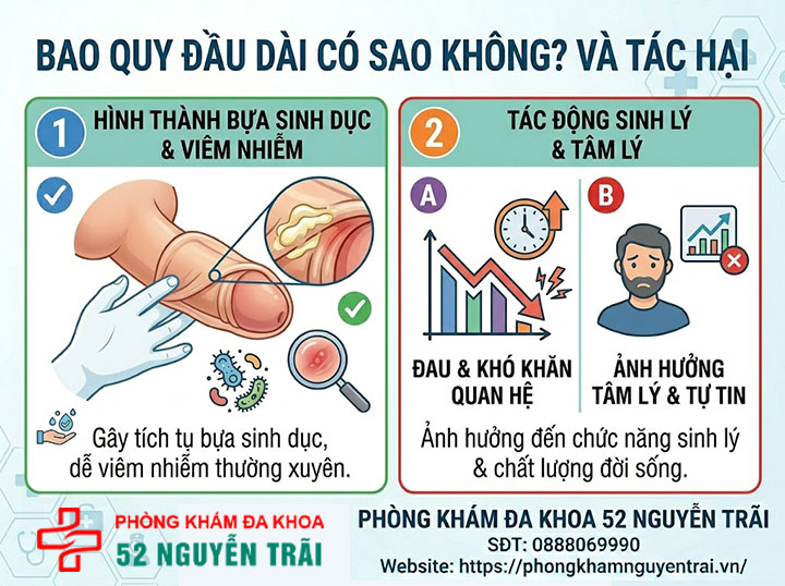 Dài hẹp bao quy đầu: Nguyên nhân và cách xử lý hiệu quả 3 Ảnh minh hoạ Bao quy đầu dài có sao không?
