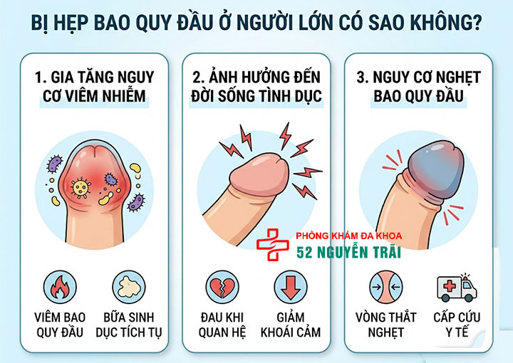 Hẹp bao quy đầu ở người lớn: Dấu hiệu và cách chữa triệt để 4 Ảnh minh hoạ: Bị hẹp bao quy đầu ở người lớn có sao không?