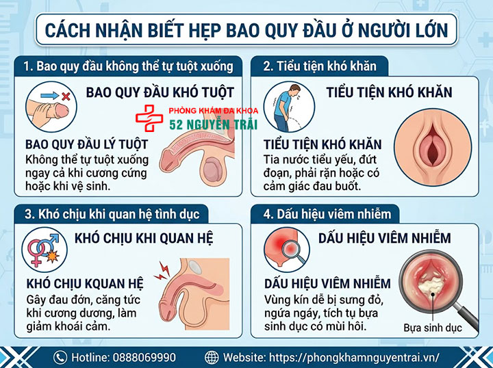 Hẹp bao quy đầu ở người lớn: Dấu hiệu và cách chữa triệt để 2 Ảnh minh hoạ Cách nhận biết hẹp bao quy đầu ở người lớn