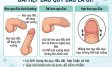 Dài hẹp bao quy đầu: Nguyên nhân và cách xử lý hiệu quả
