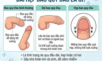 Ảnh minh hoạ Dài hẹp bao quy đầu