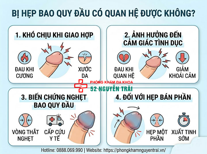 Hẹp bao quy đầu có quan hệ được không? Có gây vô sinh? 2 Ảnh minh hoạ: Hẹp bao quy đầu có quan hệ được không