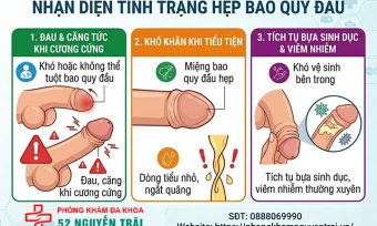 Ảnh minh hoạ Nhận diện tình trạng hẹp bao quy đầu