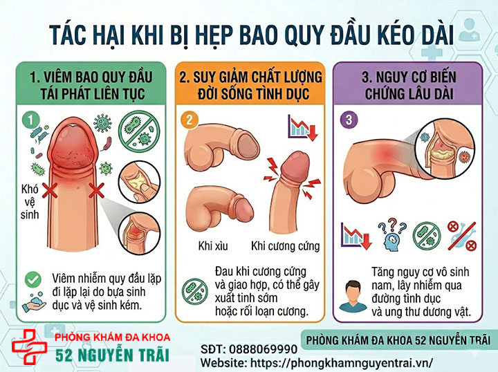 Hẹp bao quy đầu: Dấu hiệu nhận biết và cách điều trị an toàn 5 Ảnh minh hoạ Tác hại khi bị hẹp bao quy đầu kéo dài
