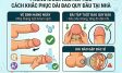 Cách khắc phục dài bao quy đầu tại nhà và cảnh báo từ bác sĩ