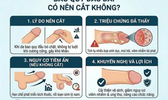Hình ảnh minh hoạ Bao quy đầu dài có nên cắt không?