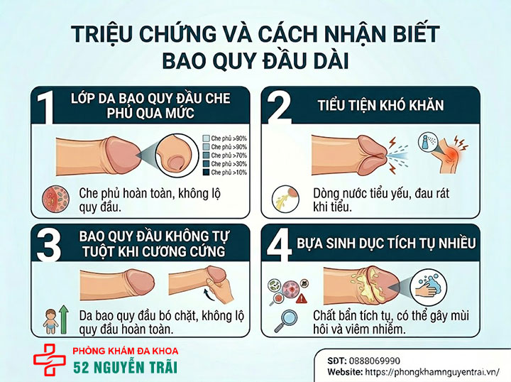 Bao quy đầu dài có nên cắt không? Tư vấn từ chuyên gia Nam học 3 Hình ảnh minh hoạ Triệu chứng và cách nhận biết bao quy đầu dài