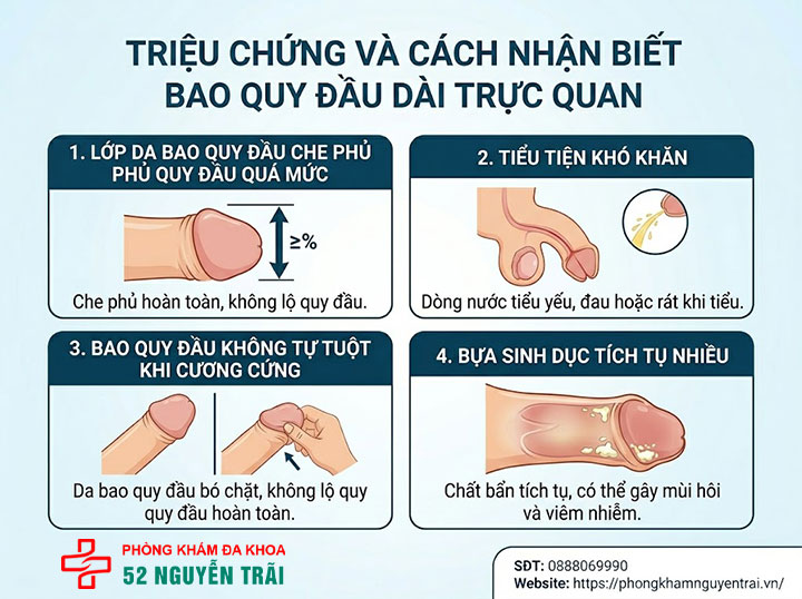Bệnh dài bao quy đầu: Nguyên nhân, triệu chứng và cách chữa 4 Hình ảnh minh hoạ cách nhận biết bao quy đầu dài