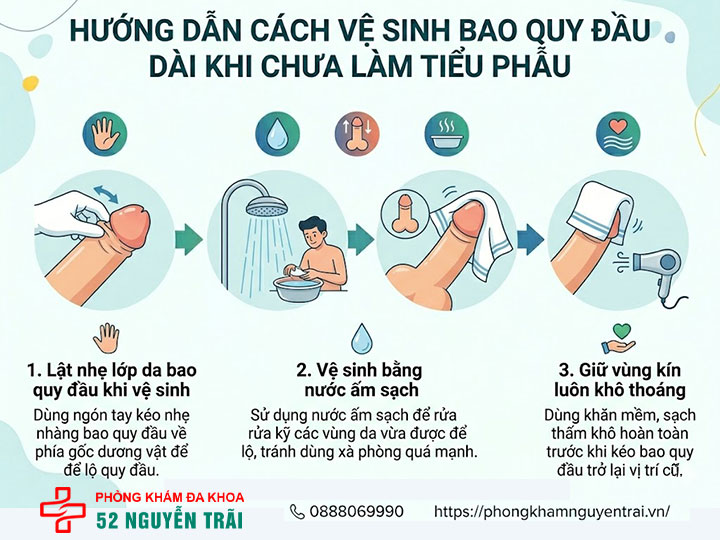 Cách khắc phục dài bao quy đầu tại nhà và cảnh báo từ bác sĩ 7 Hướng dẫn cách vệ sinh bao quy đầu dài khi chưa làm tiểu phẫu