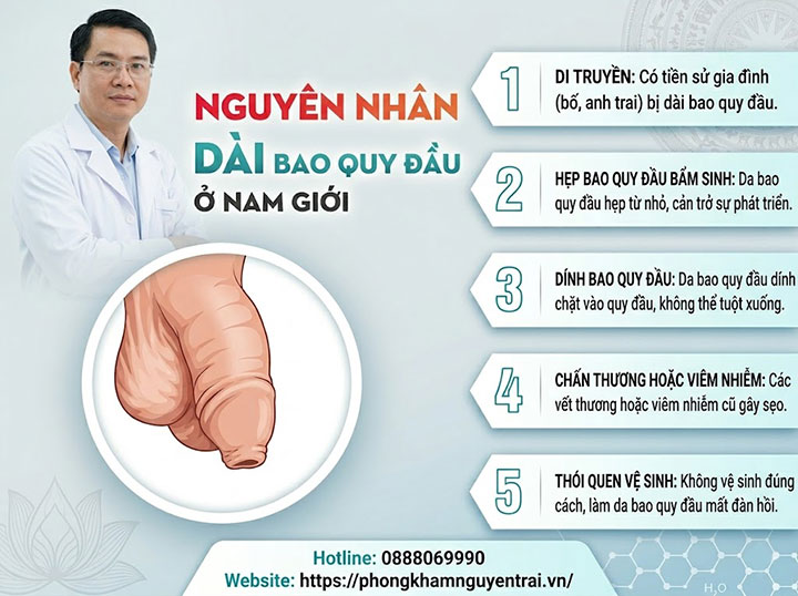Bệnh dài bao quy đầu: Nguyên nhân, triệu chứng và cách chữa 4 Nguyên nhân dài bao quy đầu