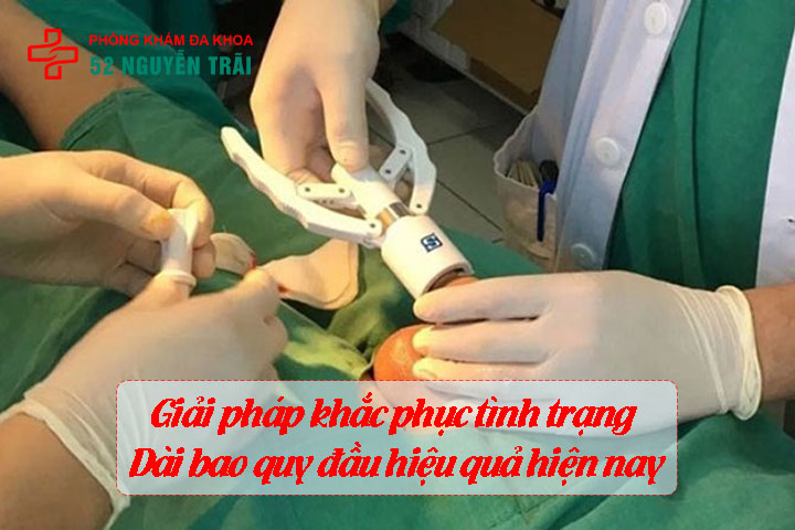 Dài bao quy đầu có quan hệ được không? Góc nhìn chuyên gia 7 cách chữa bao quy đầu dài